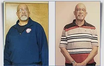 Patient Success Stories at The Institute of Weight Management and Wellness in Hackensack, NJ