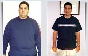 Patient Success Stories at The Institute of Weight Management and Wellness in Hackensack, NJ