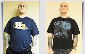 Patient Success Stories at The Institute of Weight Management and Wellness in Hackensack, NJ