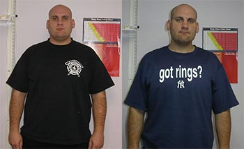 Patient Success Stories at The Institute of Weight Management and Wellness in Hackensack, NJ