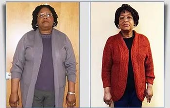 Patient Success Stories at The Institute of Weight Management and Wellness in Hackensack, NJ