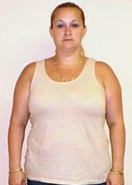 Angela’s Success Story at The Institute for Weight Management & Wellness in Hackensack, NJ Angela’s Success Story at The Institute for Weight Management & Wellness in Hackensack, NJ