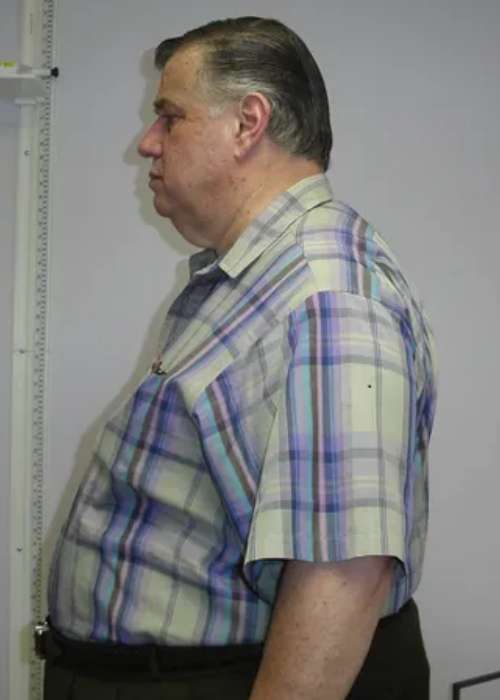 Harvey's Success Story at The Institute for Weight Management & Wellness in Hackensack, NJ