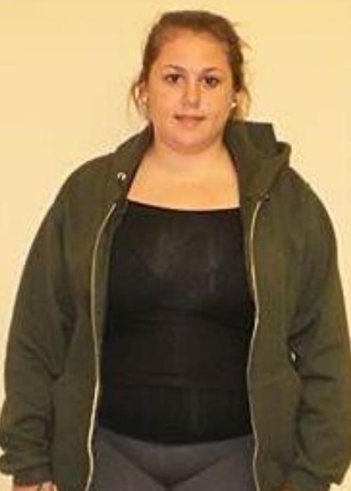 Hayley’s Success Story at The Institute for Weight Management & Wellness in Hackensack, NJ Hayley’s Success Story at The Institute for Weight Management & Wellness in Hackensack, NJ