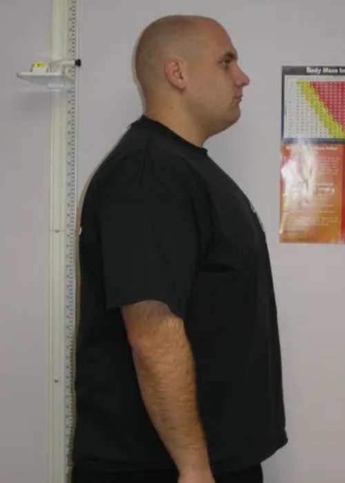 John's Success Story at The Institute for Weight Management & Wellness in Hackensack, NJ John's Success Story at The Institute for Weight Management & Wellness in Hackensack, NJ