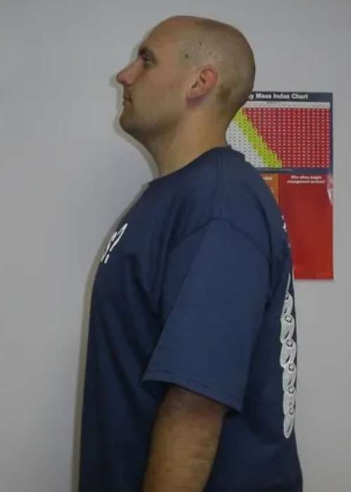 John's Success Story at The Institute for Weight Management & Wellness in Hackensack, NJ John's Success Story at The Institute for Weight Management & Wellness in Hackensack, NJ