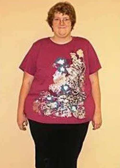 Michelle’s Success Story at The Institute for Weight Management & Wellness in Hackensack, NJ