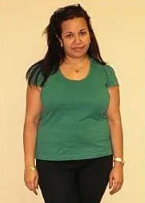 Rachel’s Success Story at The Institute for Weight Management & Wellness in Hackensack, NJ Rachel’s Success Story at The Institute for Weight Management & Wellness in Hackensack, NJ