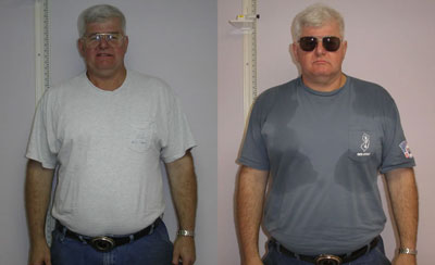 Patient Success Stories