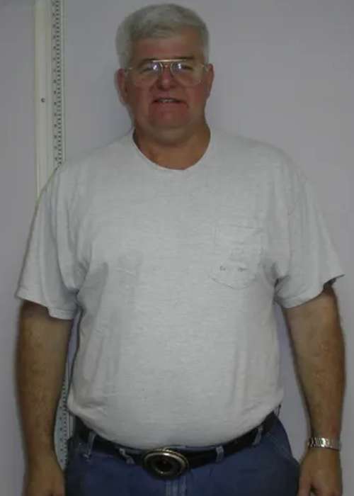 Tom's Success Story at The Institute for Weight Management & Wellness in Hackensack, NJ Tom's Success Story at The Institute for Weight Management & Wellness in Hackensack, NJ