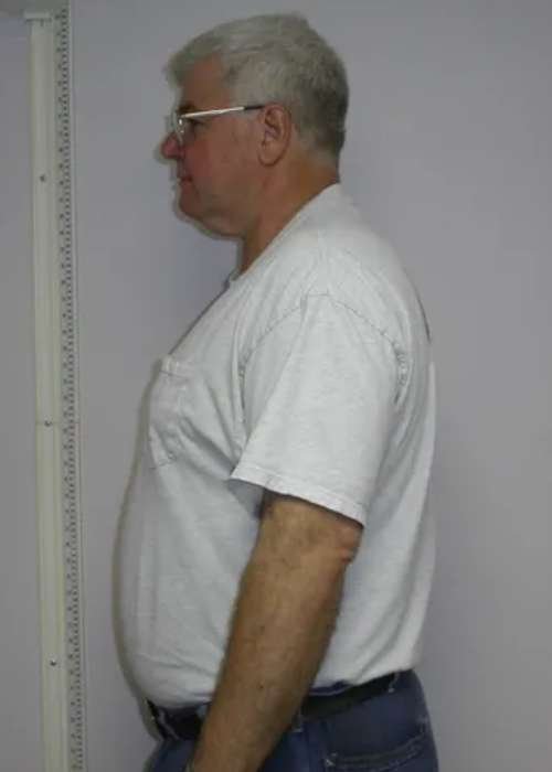 Tom's Success Story at The Institute for Weight Management & Wellness in Hackensack, NJ Tom's Success Story at The Institute for Weight Management & Wellness in Hackensack, NJ